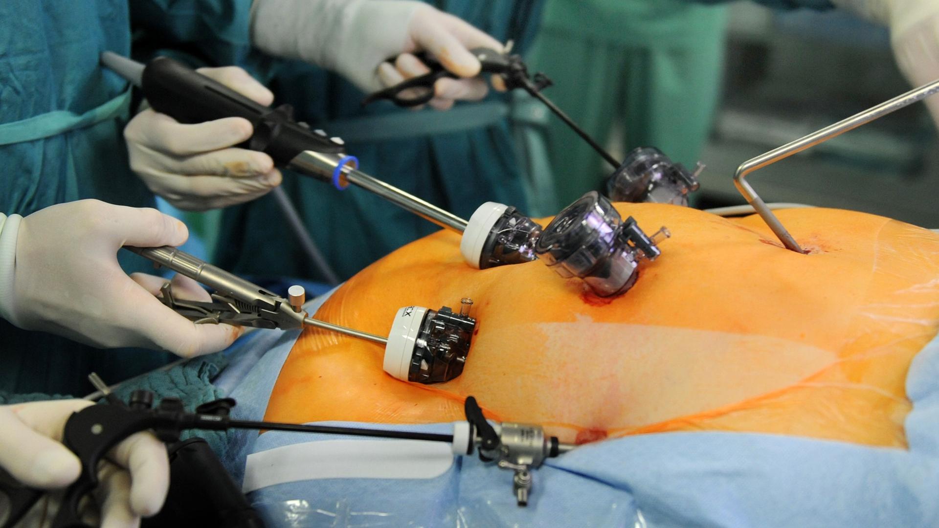 Experience Safe, Affordable Surgery with Gastric Sleeve Turkey Clinics